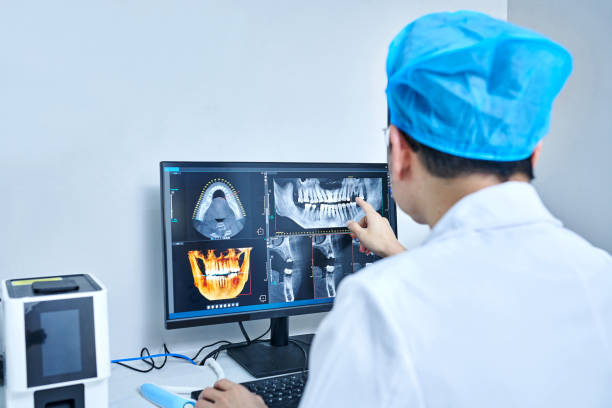 Best Knocked-Out Tooth (Avulsed Tooth) Treatment in Aspen, CO